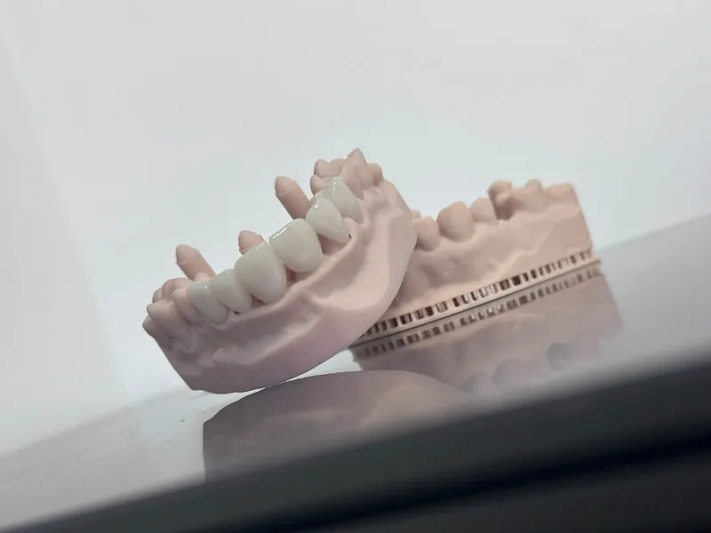Model dentar cu o lucrare protetică, pe o masă albă.