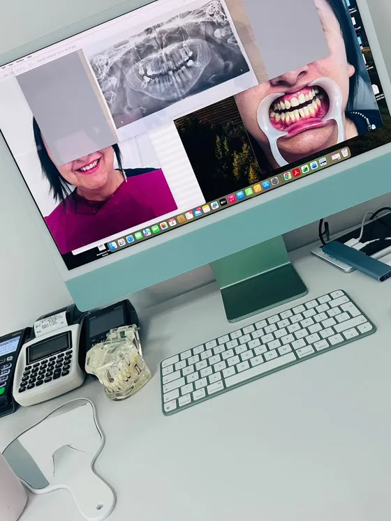Monitor cu radiografia și fotografiile unui pacient, cu fața acoperită, pregătite pentru planificarea tratamentului.
