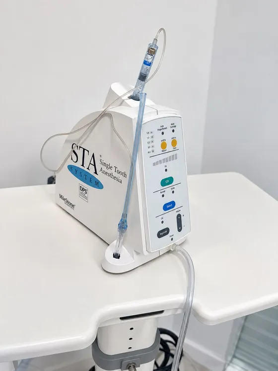 Sistemul de anestezie digitală STA (Single Tooth Anesthesia), pe masa din cabinet.